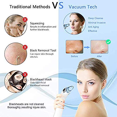 Blackhead Vacuum, 2019 Upgraded Rechargeable Blackhead Vacuum Suction Remover, Professional Portable Pore Vacuum Led Display Electric Pore Suction Vacuum with 4 Beauty Probes for Men for women