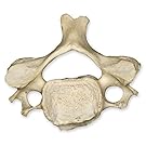 Real Human Vertebra (Cervical) (Natural Bone Quality A)