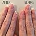Crystal Glass Nail File Buffer Nail Shaper - Nail Files for Natural Nails, Nail Care Kit with Case, Shine Buffing Filing Fingernail Polisher, Professional Salon Manicure, Gentle for Baby Kids, Travel