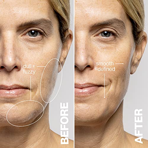 DERMAFLASH â€“ LUXE Device â€“ Exfoliating, Hair Removal (Icy Pink) , 1