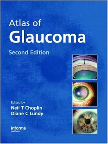 Ù†ØªÙŠØ¬Ø© Ø¨Ø­Ø« Ø§Ù„ØµÙˆØ± Ø¹Ù† â€ªAtlas of Glaucomaâ€¬â€