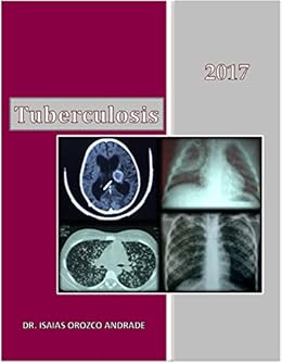 Amazoncom Tuberculosis 2017 Edición En Español Spanish - 