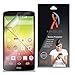 XShields© (5-Pack) Screen Protectors for LG Tribute (Ultra Clear)