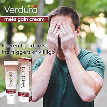 white patches on skin ointment