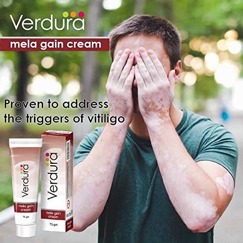 Herbal Aid Mela Gain Cream Vitiligo White Patches Skin Treatment