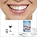 LoveYourSmile Teeth Whitening Kit