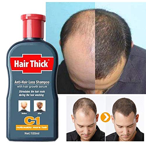 Fast Hair Growth Shampoo Herbal Repair Damaged Coarse Anti Hair Loss Serum Unisex (100ml)