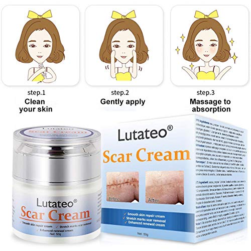 Scar Cream, Stretch Mark Cream, Acne Scar Removal Cream, Acne Spots