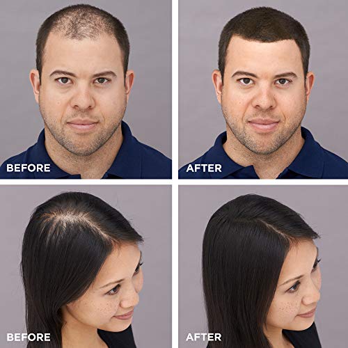 TOPPIK HAIR BUILDING FIBERS, BLACK, 12G FILL IN FINE OR THINNING HAIR INSTANTLY THICKER, FULLER LOOKING HAIR 9 SHADES FOR MEN WOMEN