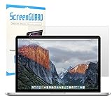 TOP CASE - Retina 13-Inch Ultra-Clear High Definition (HD) LCD Screen Guard for Old Generation MacBook Pro 13
