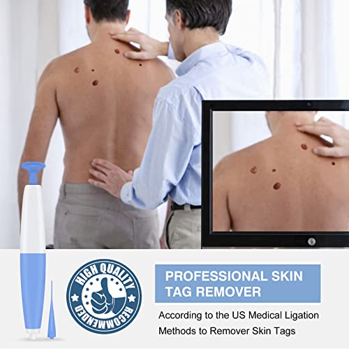 Skin Tag Remover, Skin Tag Removal Kit Tools for Small to Medium Skin Tags, Easy Application