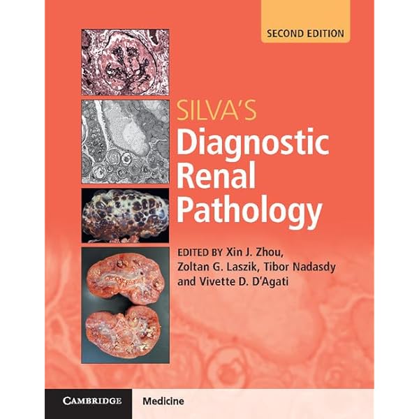 健康・医学 HEPTINSTALL'S PATHOLOGY of the KIDNEY Heptinstall's Pathology of the Kidney: 9781975161538