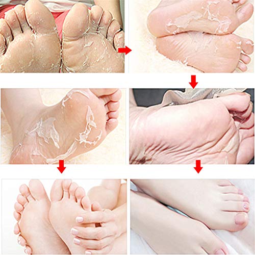 Foot Peel Mask, Cracked Heel Treatment Foot Peeling Mask Dead Skin Remover for Feet Baby Soft Foot Mask 1 Pair (B)