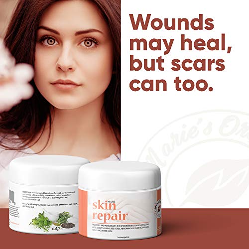 All-Natural Skin Healing Cream - Treats and Soothes Wounds, Burns, Cellulitis, Hemorrhoids, Rashes, Sore Nipples and More - Plant-Based Vitamin Ointment - by Marie's Originals - Thumbnail 3