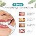 Teeth Whitening Pen, 35% Carbamide Peroxide, 15+ Whitening Treatments, No Sensitivity, 2mL (2 pack)