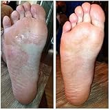 Imperial Feet Foot Cream XL 75 ml Natural Foot Care for Dry Skin view 4