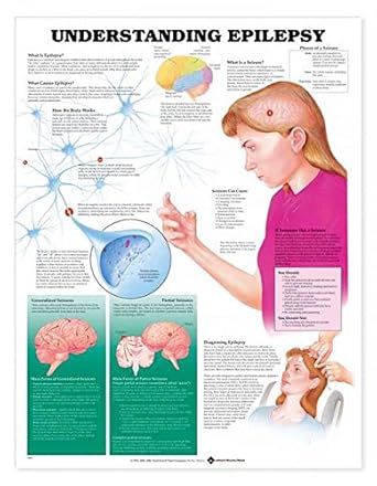 Epilepsy and seizures picture