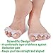 Bunion Corrector,Bunion Splint,Gel Bunion Pads for Foot Health Care,Toe Separators Spacers Straighteners-Relief Pain in Hallux Vagus,Big Toe,Tailors Bunion.Big Toe Joint.