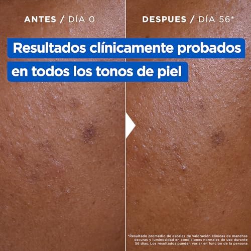 Niacinamide Bright Crema Corporal Antimanchas para Piel Apagada, 400ml