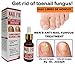 Antifungal FEM Get rid of toenail Fungus Uñas libres de Hongos 15 mlthumb 3