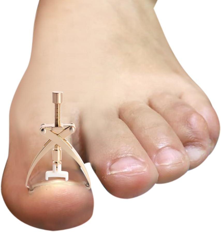 Professional Stainless Steel Ingrown Toe Nail Correction Tool Pedicure Tool: Health & Personal Care