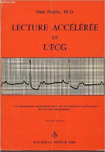 Amazon Fr Lecture Acceleree De L Ecg Un Enseignement Programme Pour Une Interpretation Systematique Des Electrocardiogrammes Troisieme Edition Livres Amazon Fr Lecture Acceleree De L Ecg Un Enseignement Programme Pour Une Interpretation Systematique Des Electrocardiogrammes Troisieme Edition Livres