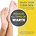 Gentle Wart Removal – USA Made – 48h Action Wart Treatment – Genital, Common, Plantar Wart Remover – Naturally Removes Warts – Wart Liquid for More Efficacy than Wart Stick – Fast & Lasting Resultthumb 4