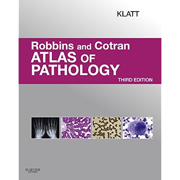 Amazon.com: Robbins & Cotran Pathologic Basis of Disease (Robbins