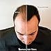 Samson Hair Fibers for Thinning Hair - 100% Undetectable Natural Formula - Completely Conceals Hair Loss in Seconds. Covers bald spots. Thicken your hair instantly - 25 Grams Refill (DARK BROWN)
