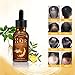 Hair Growth Essential Oil Fleeceflower Root Ginger Extract Hair Care Serum Stops Hair Loss Promotes Hair Regrowth Topical Treatment for Thinning Hair for Women & Menthumb 1