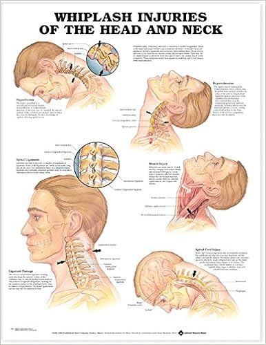 Science Education Industrial Scientific Montibello Com Anatomy And Injuries Of The Head And Neck Chart