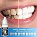 Teeth Whitening and Brightening Essence Helps Remove Stains from Coffee,Wine,Smoking,Soda…