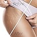 Shea Butter for Body, Stretch Marks Removal Cream: Feel Silky Smooth! Moisturizer for Dry Skin, Eczema Treatment, Pregnancy Belly Lotion with Natural & Organic Ingredients & Dead Sea Minerals (250 ml)