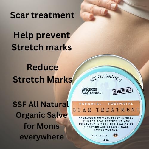 SSF Organics Scar Treatment for Stretch Marks, C-Section Recovery Must Have- Deeply Moisturize with Calendula, Castor, Shea - Advanced Scar Treatment for Mama Related Wounds