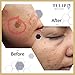 Skin Brightening & Lightening Cream - Hyperpigmentation & Dark Spots Corrector, for All Skin Types - Vitamin A Retinol Fade Cream for Skin Discoloration, Acne Scars, Sun Spots by Tulip Natural, 1.7oz