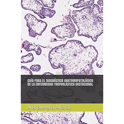 GUÍA PARA EL DIAGNÓSTICO ANATOMOPATOLÓGICO DE LA ENFERMEDAD TROFOBLÁSTICA GESTACIONAL