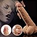 Realistic Vibrating Dildo G-spot Vibrator with 360°Rotation, Recharge Waterproof Penis with Suction Cup and Remote Control, Treediride Clit Nipples Stimulator Massager for Women or Couple