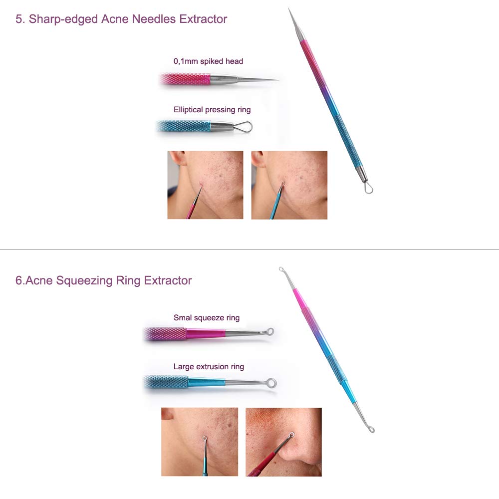 ZIZZON Blackhead Remover Kit Pimple Comedone Extractor Tool Set Treatment for Blemish, Zit, Acne Whitehead Tweezers Kit with 10X Magnifying Mirror: Beauty