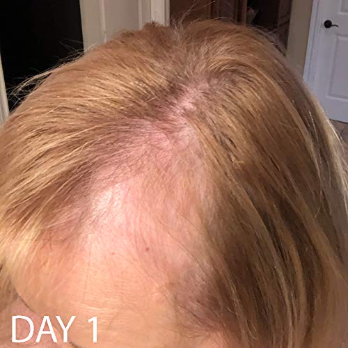 Biotin Vitamin Hair Growth Conditioner(High Potency) Biotin