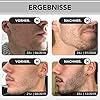Anthony Brown Beard Growth Kit bartwuchs