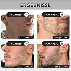 Anthony Brown Beard Growth Kit bartwuchs