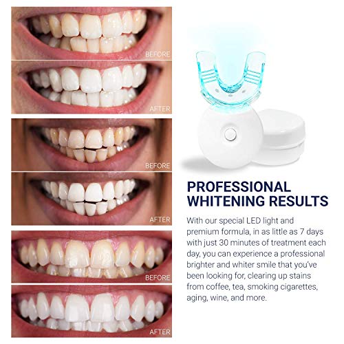 Aroamas Teeth Whitening Kit, With Led Light, for Sensitive Teeth, Comfortable Fit, Brighter Smile in 7 Days