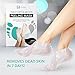 Foot Peel Mask 2 Pack, Peeling Away Calluses and Dead Skin cells, Make Your Feet Baby Soft, Exfoliating Foot Mask, Repair Rough Heels, Get Silky Soft Feet by Lavinsothumb 1