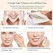 Blackhead Remover Vacuum Pore Cleanser - Best Selling Acne Extractor Microdermabrasion Suction beauty Device USB Charge for Women Men Face Nose Treatment Kit