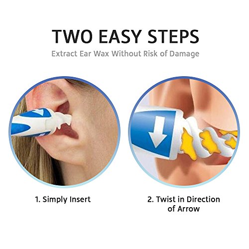 Earwax Removal Kit With 16 NewDesigned Replacement TipsEasy & Safe
