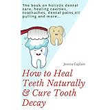 How to Heal Teeth Naturally &amp; Cure Tooth Decay: the book on holistic dental care, healing cavities, toothaches, dental pains, oil pulling and more...