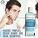 Acne Treatment: Anti Acne Deep Pore Cleansing Astringent Toner. Clears Acne. Reduce Blemishes & Redness. Salicylic Acid & Niacinamide Vitamin B3 for Healthier, Youthful Glow. 6 oz