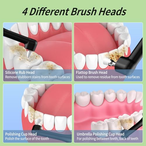 Tooth Polisher, Rechargeable Teeth Sander with 5 Brush Heads, 3 Polish Pastes, LED Light, 4 Speed Modes, Waterproof Dental Cleaning Kit for Whitening and Polishing (Black)