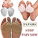 Metatarsal Pads by MEDIZED| Ball of Foot Cushions Gel Pad All Day Pain Relief and Comfort One Size Fits Shoe Inserts for Women and Men (Metatarsal Sock & Gel Pad)