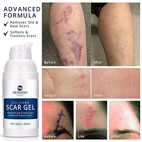 Scar Gel silicone scar gel from CSection, Stretch Marks, Acne, Surgery